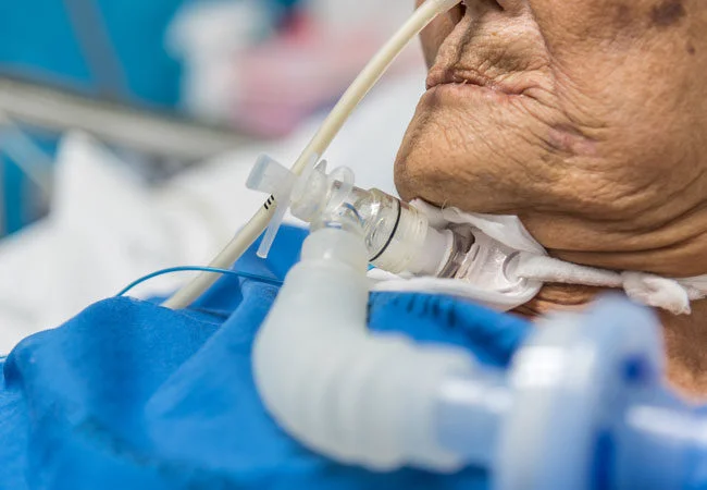 Tracheostomy Care Nurses